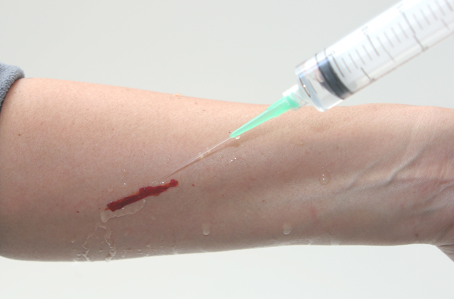 A syringe with a catheter can provide high pressure to clean out a minor wound. Deep wounds will require you to spread it open with your fingers to ensure the area is completely clean of dirt, dried blood and debris to avoid infection.